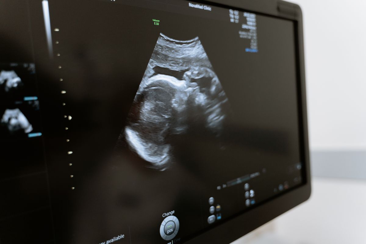 La Polyclinique renforce son plateau d'imagerie médicale